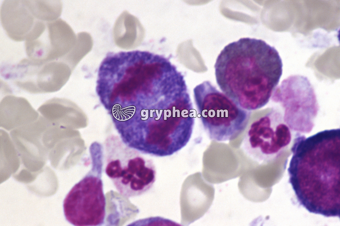 Moelle osseuse humaine cellules en mitose - anaphase x400 - gryphea.org